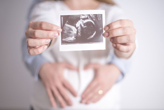 pränataldiagnostik-was-ist- Schwangere zeigt Ultraschall-Bild